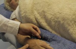 Beehive Healthcare | Reflexology, Tai Chi, Pilates and Acupuncture | Acupuncture