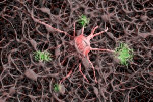 nerve cell plasticity dementia picture
